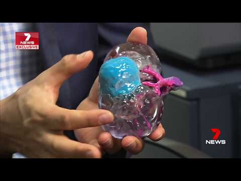 Body Print — Medical 3D Printing on 7 News